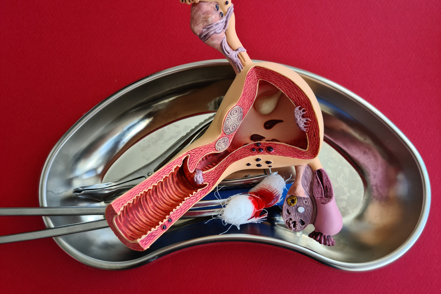 Hysterectomy surgery in Bangalore