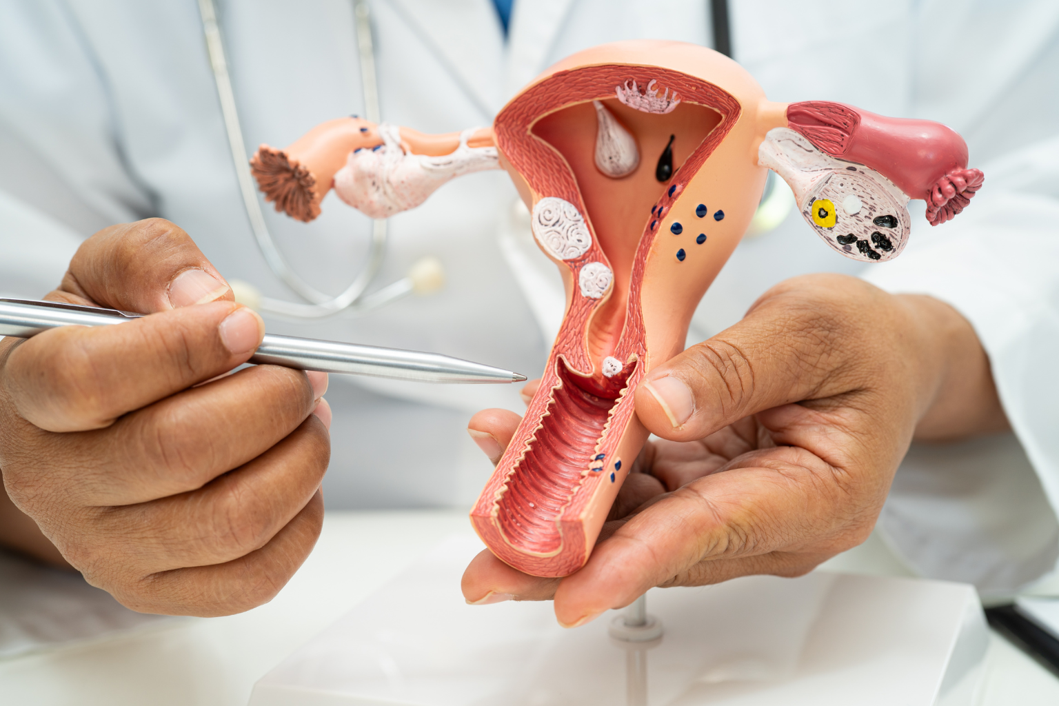 Uterus removal in Bangalore